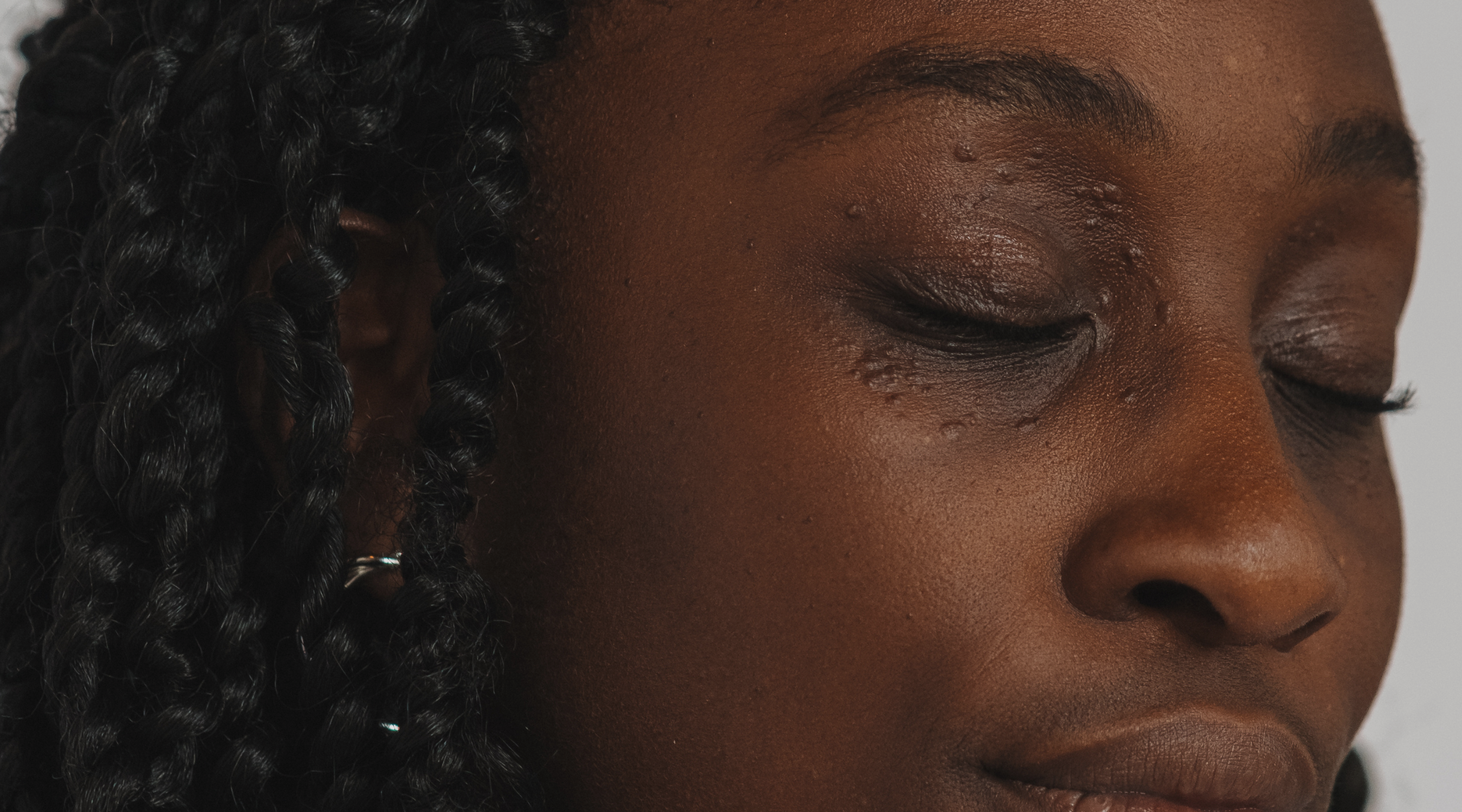 Understanding Milia: Causes, Prevention, and Treatment