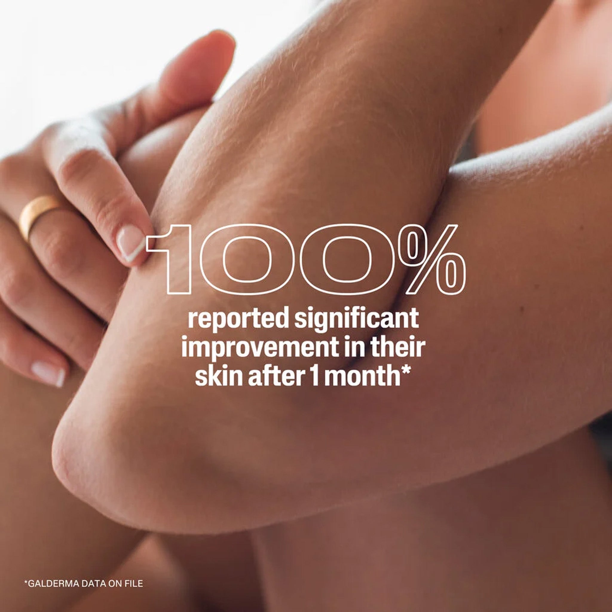 Urea 10 Healing Lotion