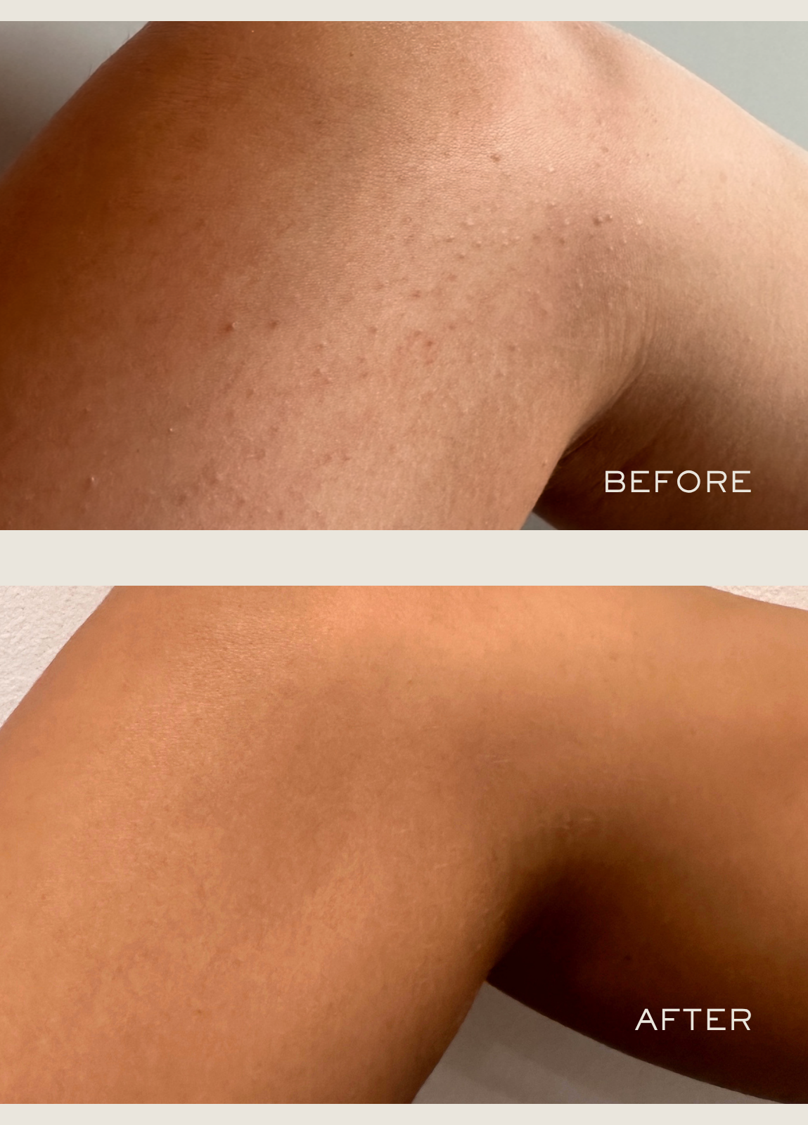 Exfoliating Body Serum