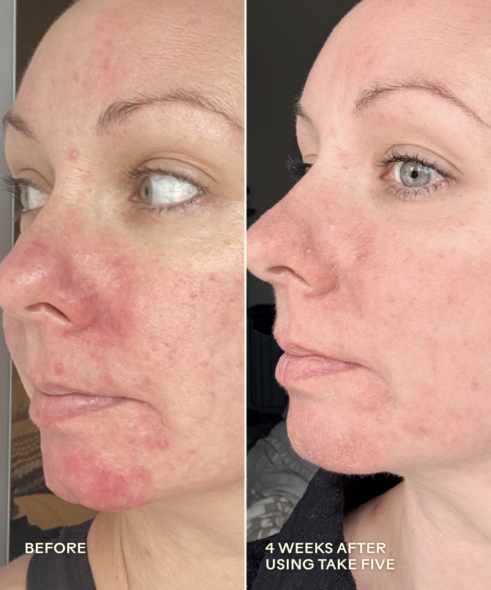 Take Five Hypochlorous Acid Balancing Body + Face Spray