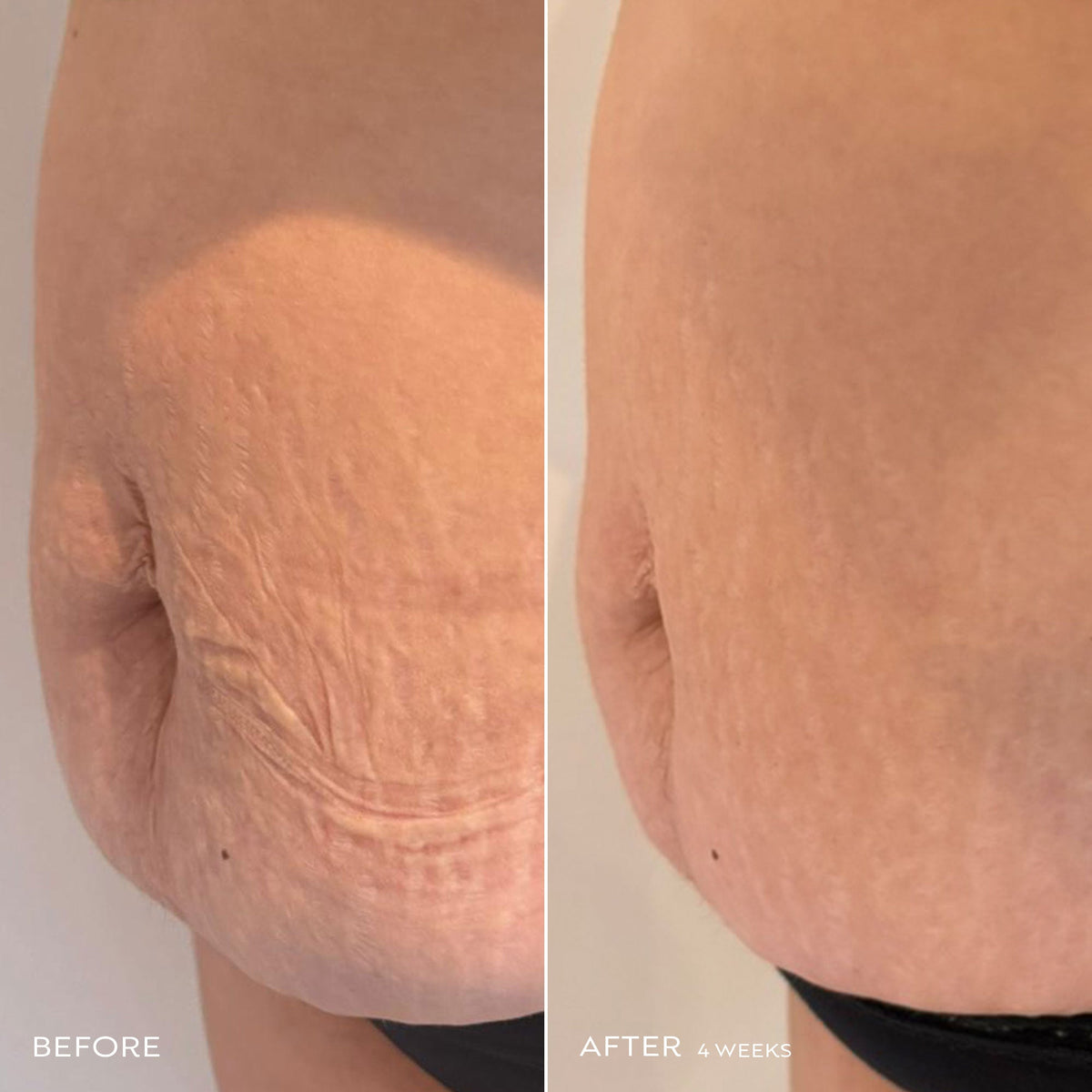 Daydreamer Body Serum