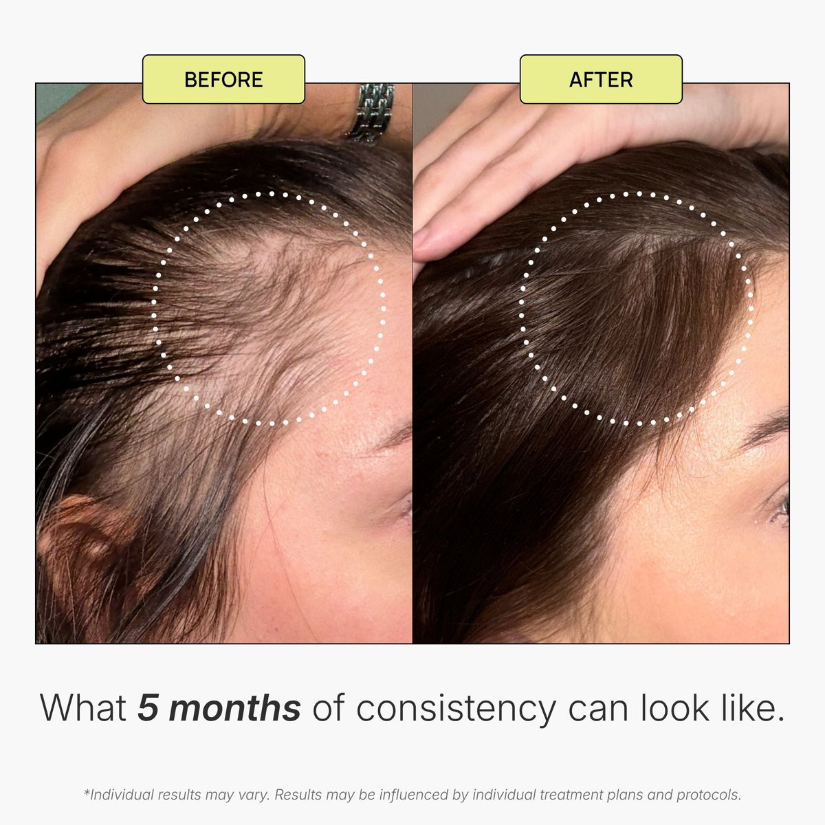 Scalp Stimulating Solution