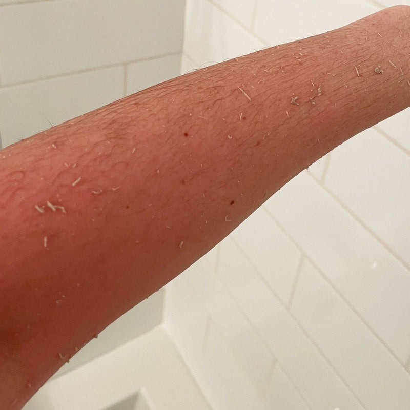 Renaissance Deep Exfoliating Kit