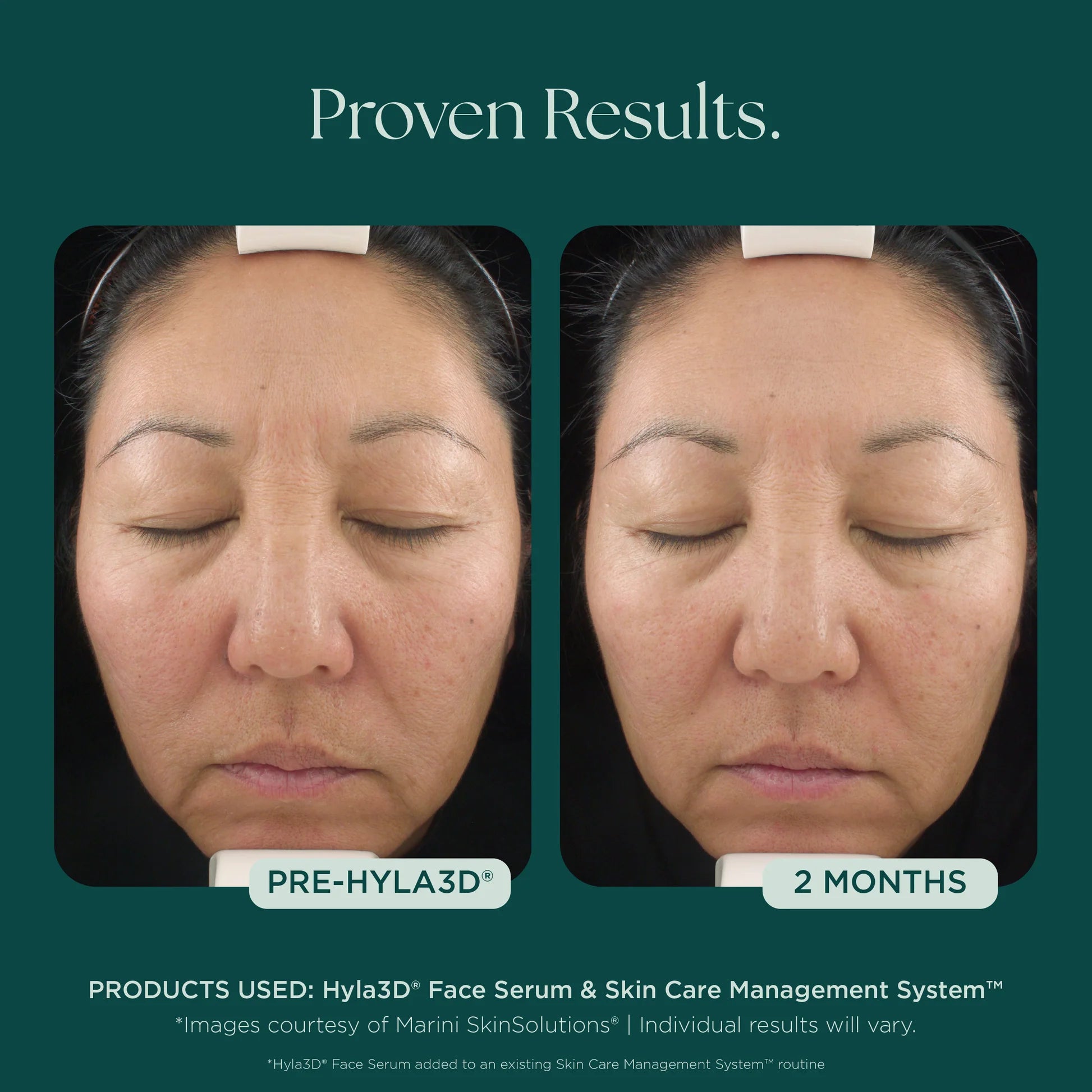 Hyla3D Face Serum