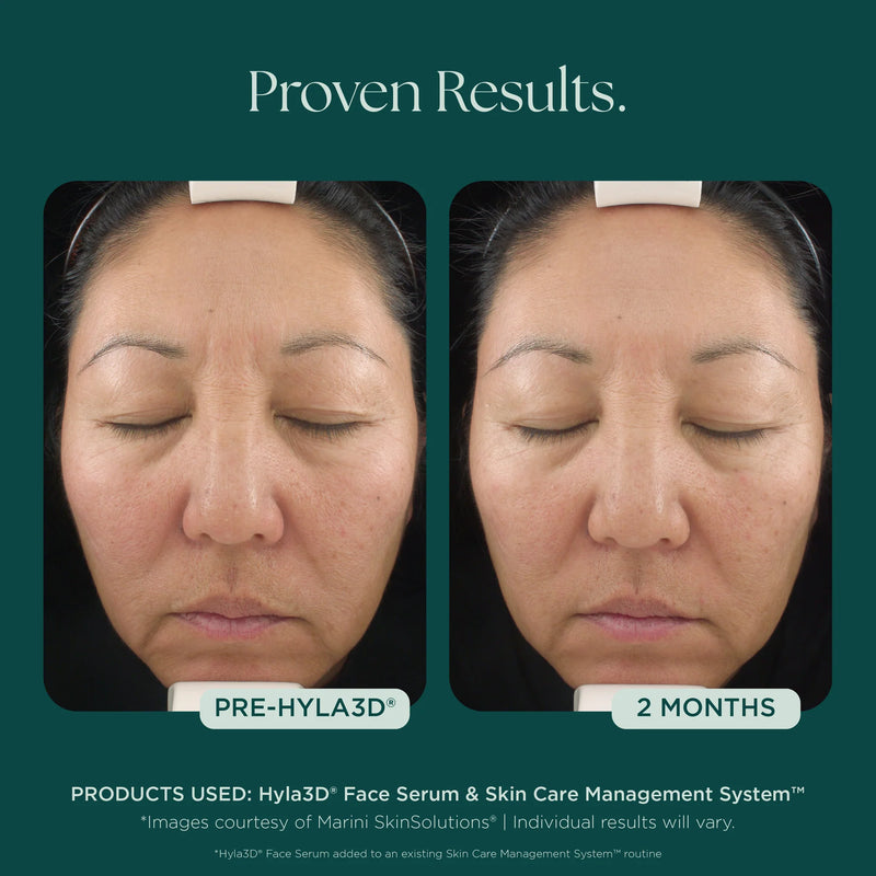 Hyla3D Face Serum