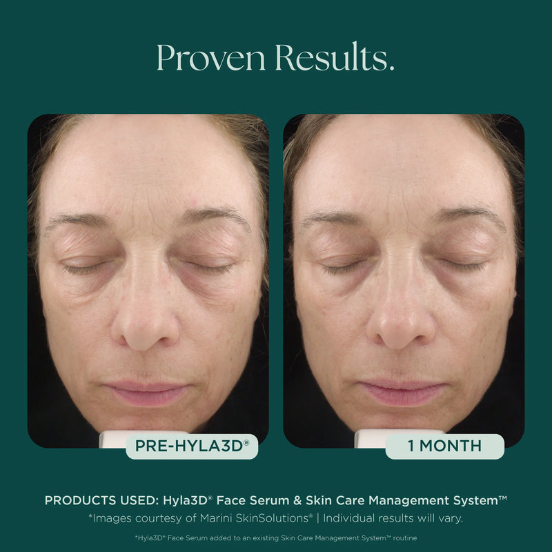 Hyla3D Face Serum