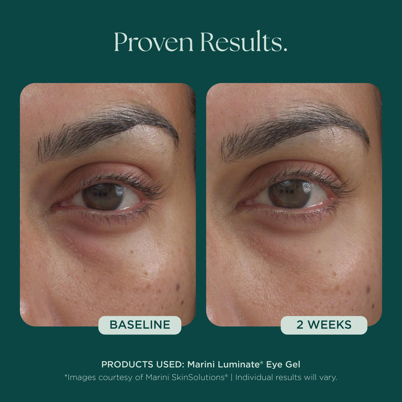Marini Luminate gel pour les yeux