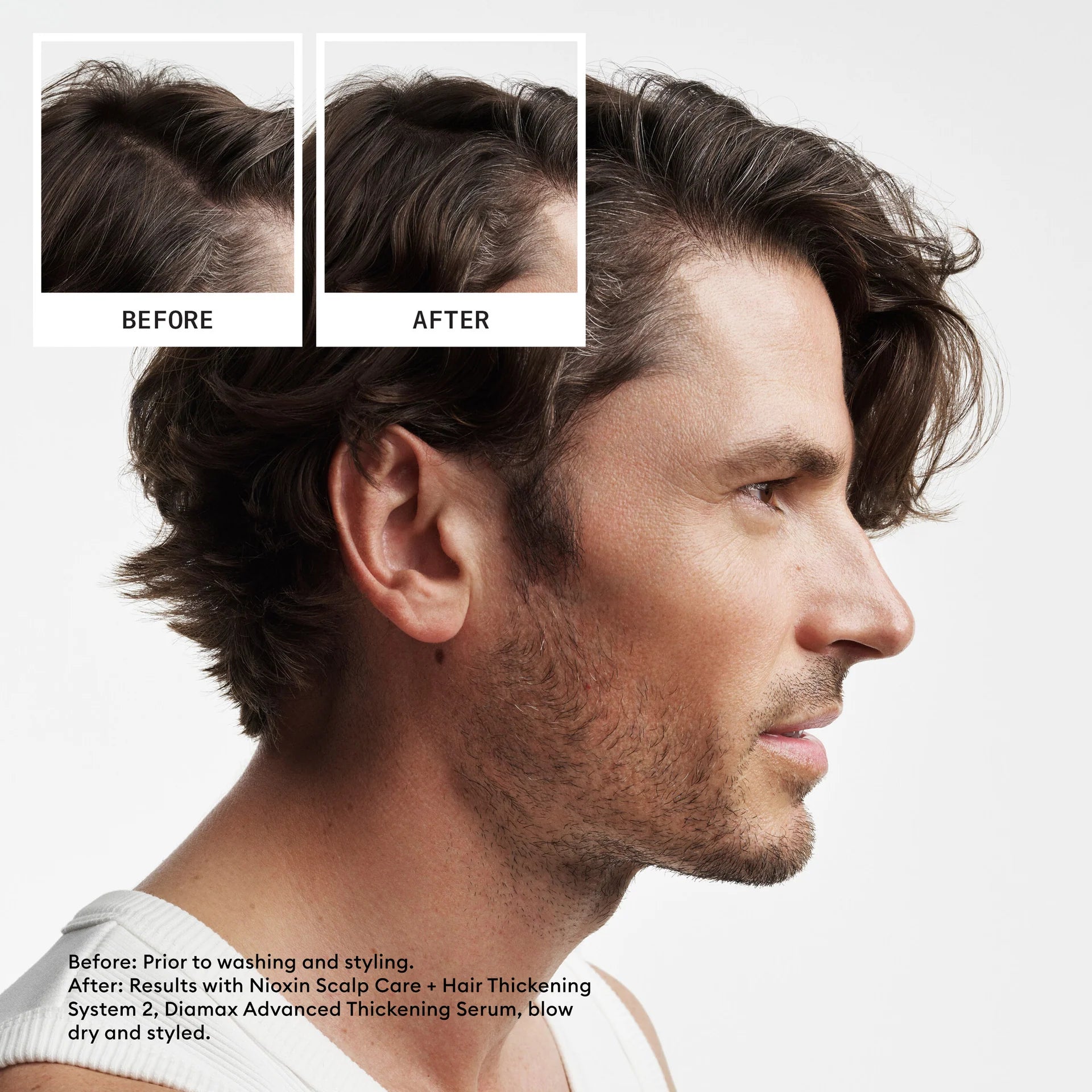 Scalp + Hair Thickening System 2