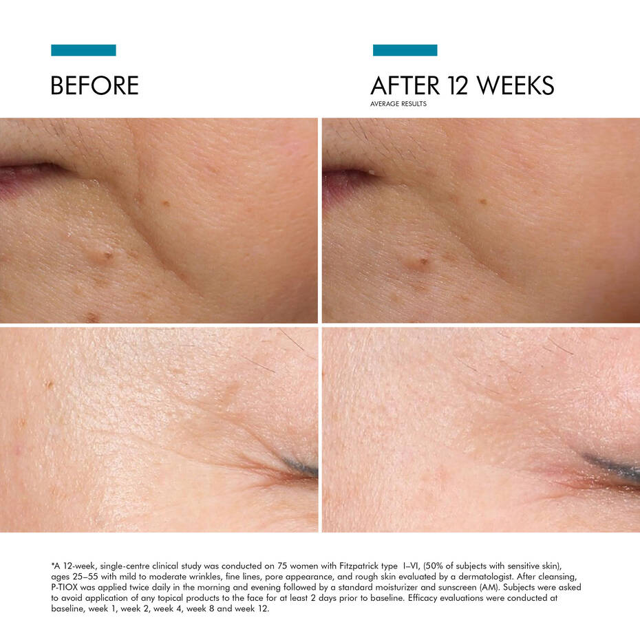 P-TIOX Anti-Wrinkle Serum