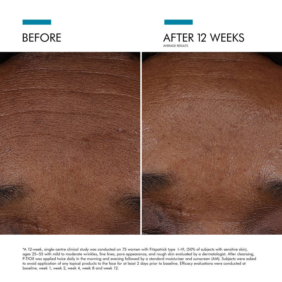 P-TIOX Anti-Wrinkle Serum