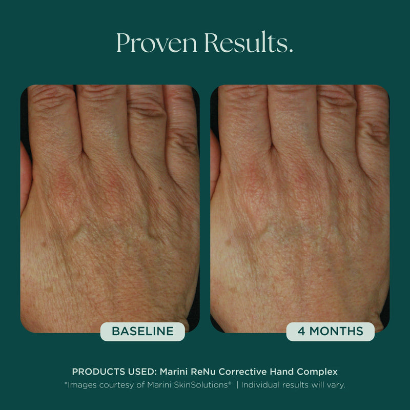 ReNu complexe correcteur pour les mains