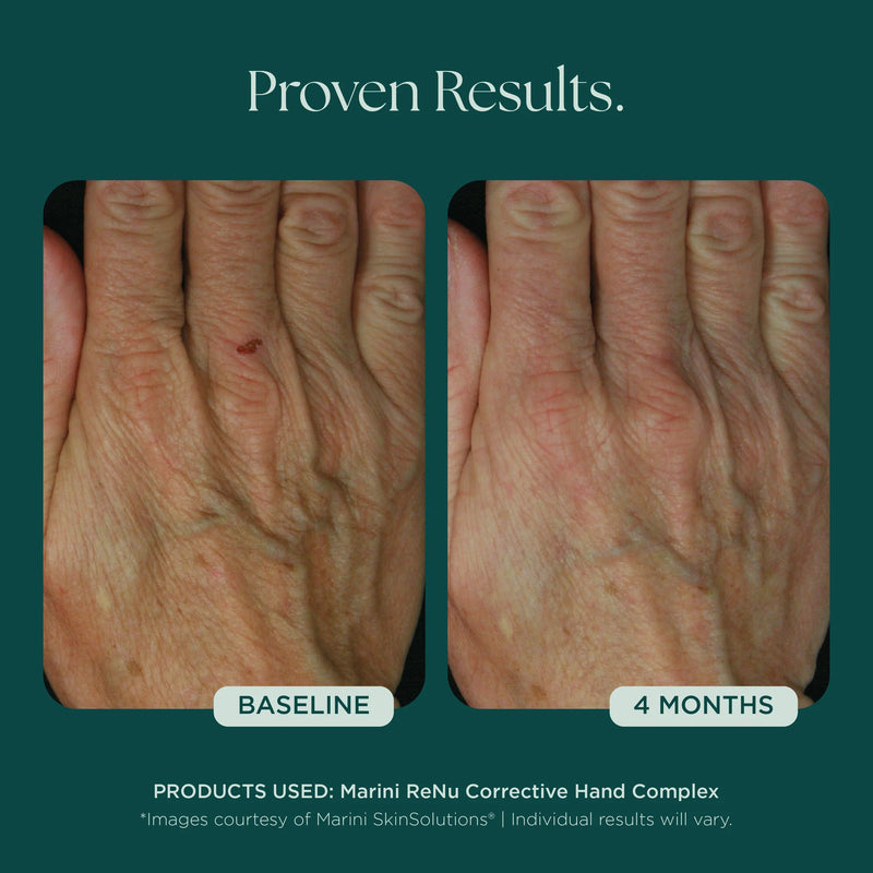 ReNu complexe correcteur pour les mains