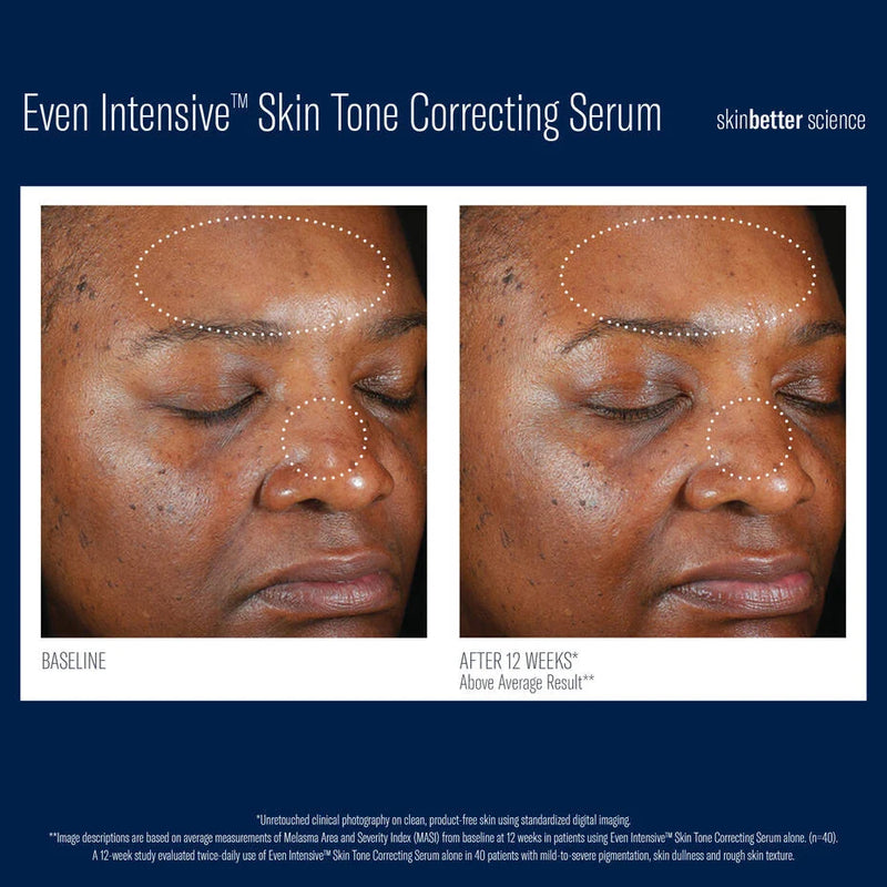 Even Intensive Skin Tone Correcting Serum