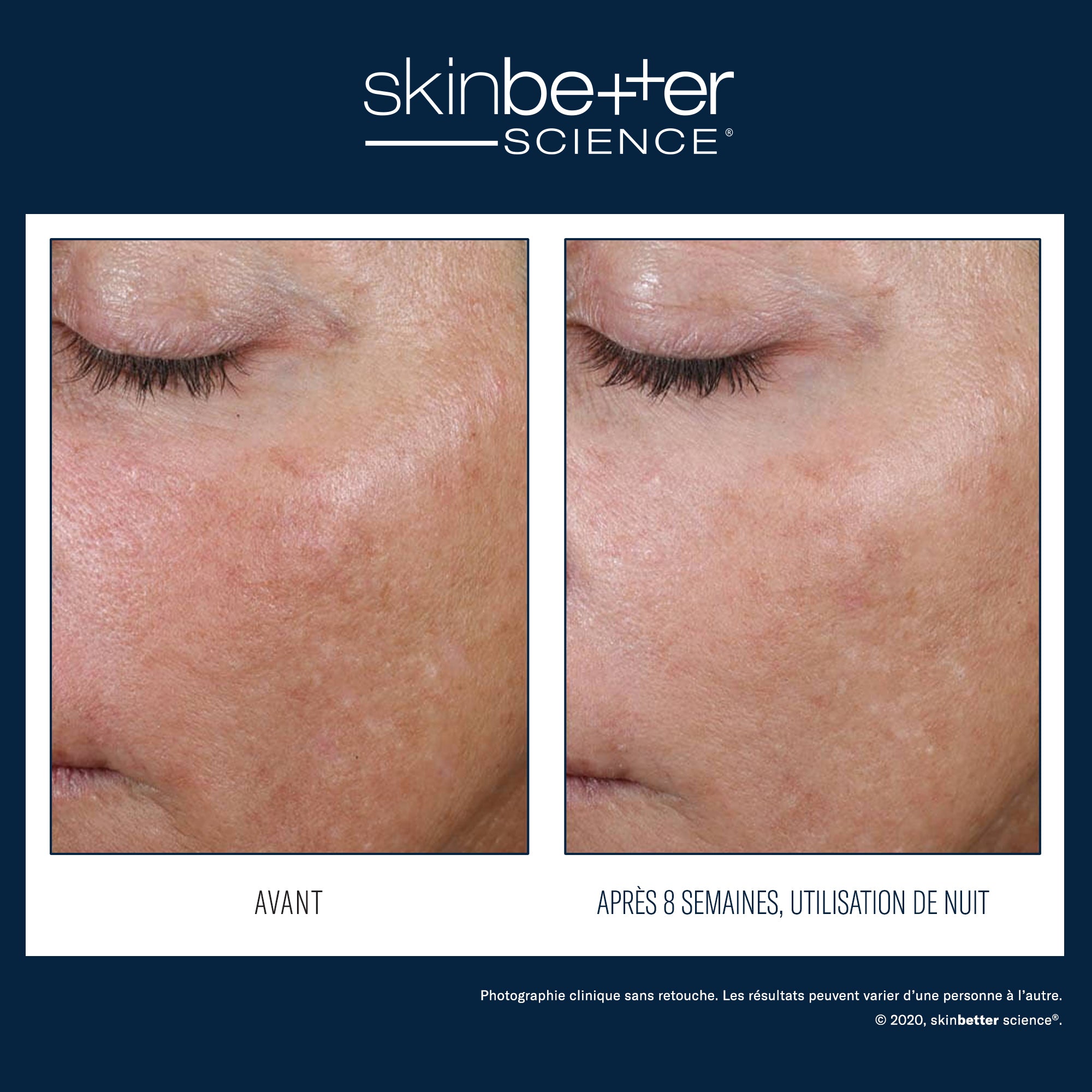 AlphaRet Overnight Cream