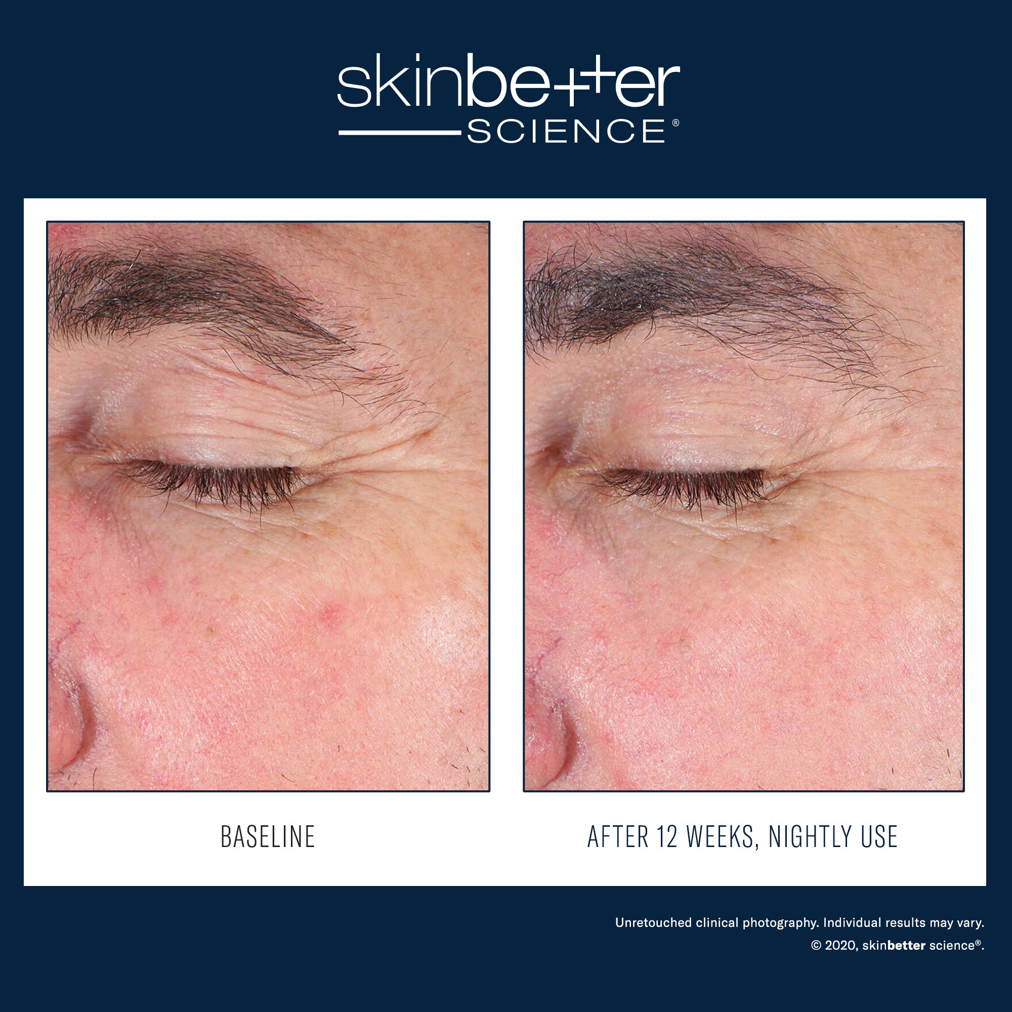 EyeMax AlphaRet Overnight Cream