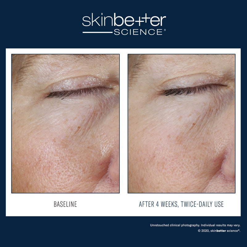 Instant Effect Gel Eye