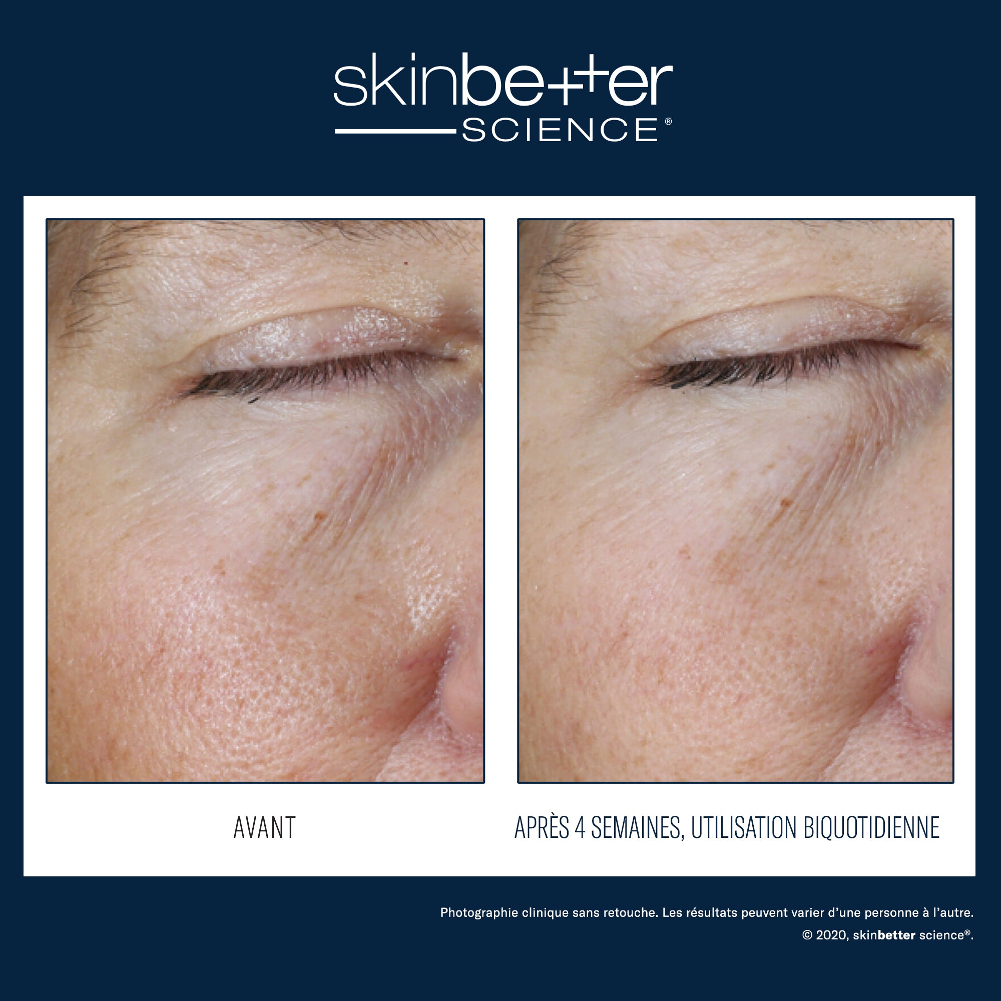 Instant Effect Gel Eye