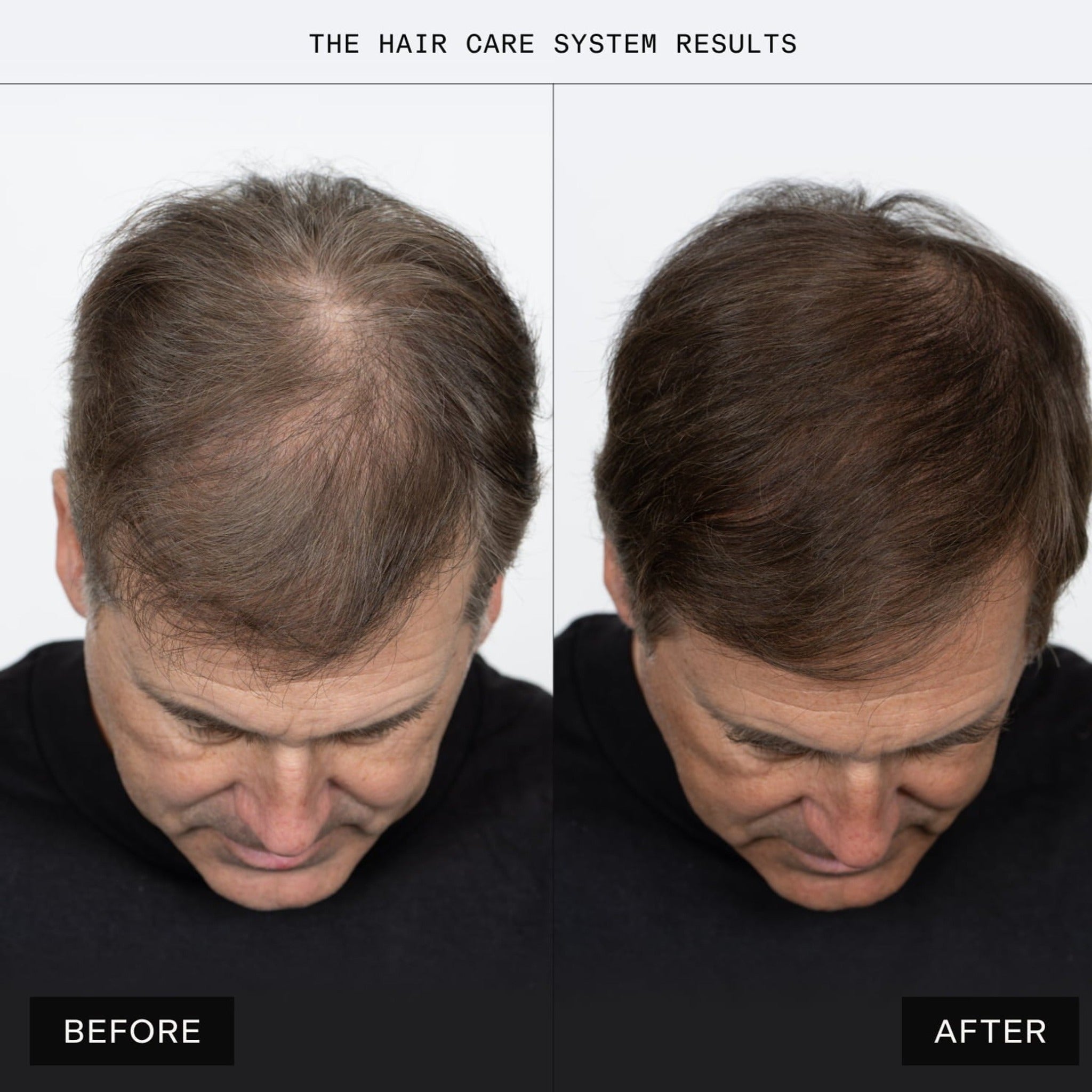 THE HAIR SERUM - Sérum fortifiant pour le cuir chevelu et les cheveux