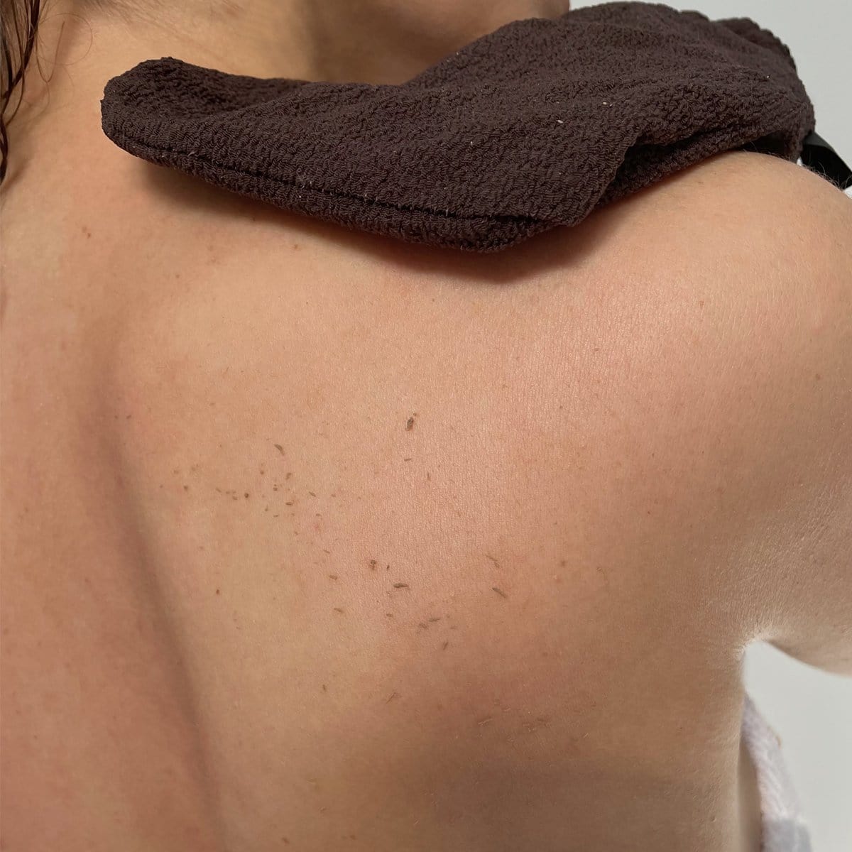 Ensemble d'exfoliation