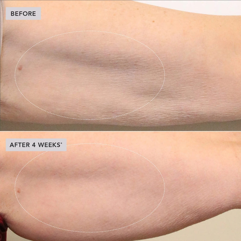 image-skin-care-vol-u-lift-body-glp-1-gip-sculpt-firm-treatment-complex-6