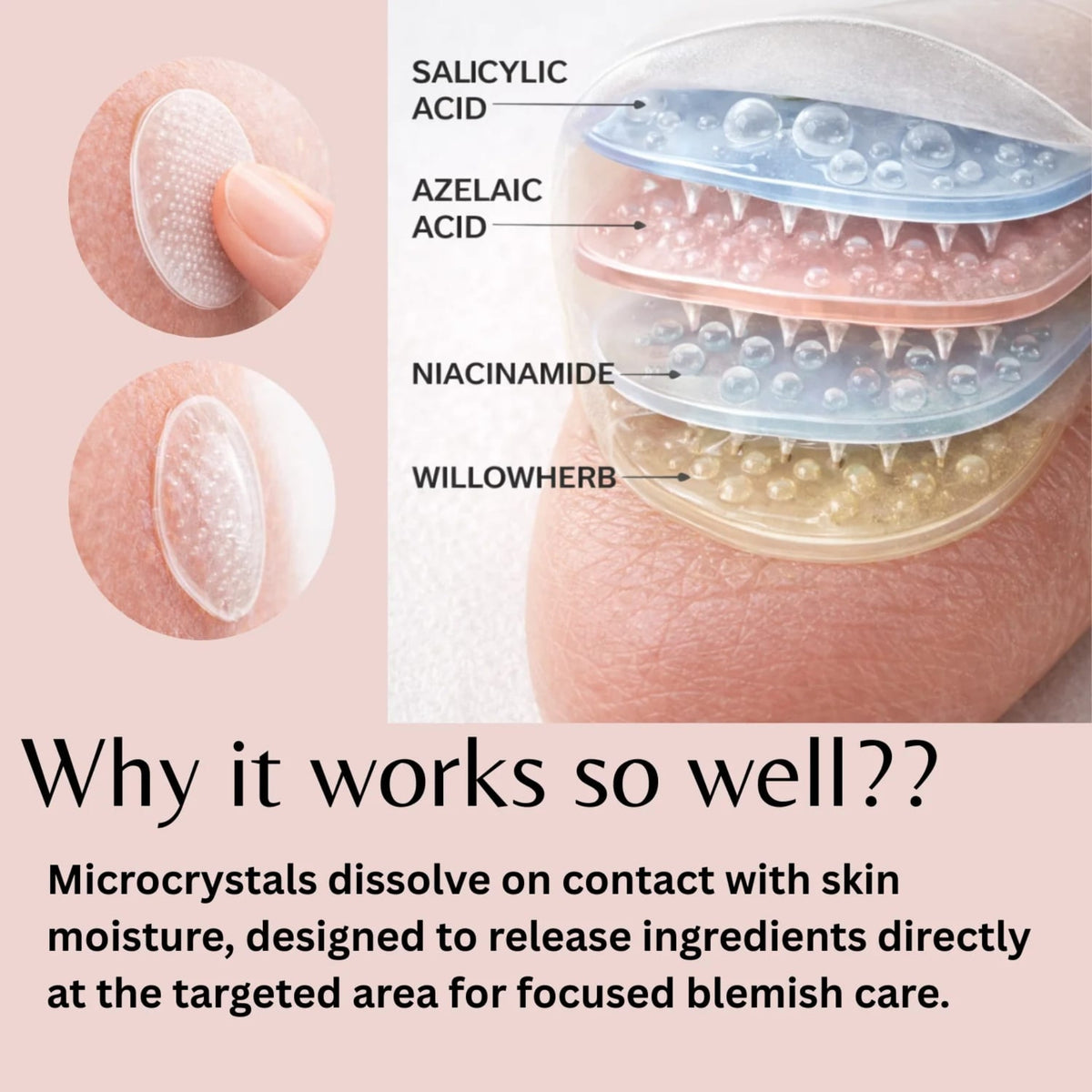 ivoryloom-microdart-spot-patch-6