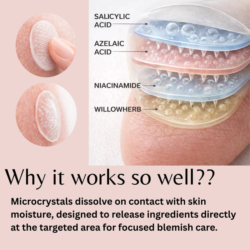 ivoryloom-microdart-spot-patch-6