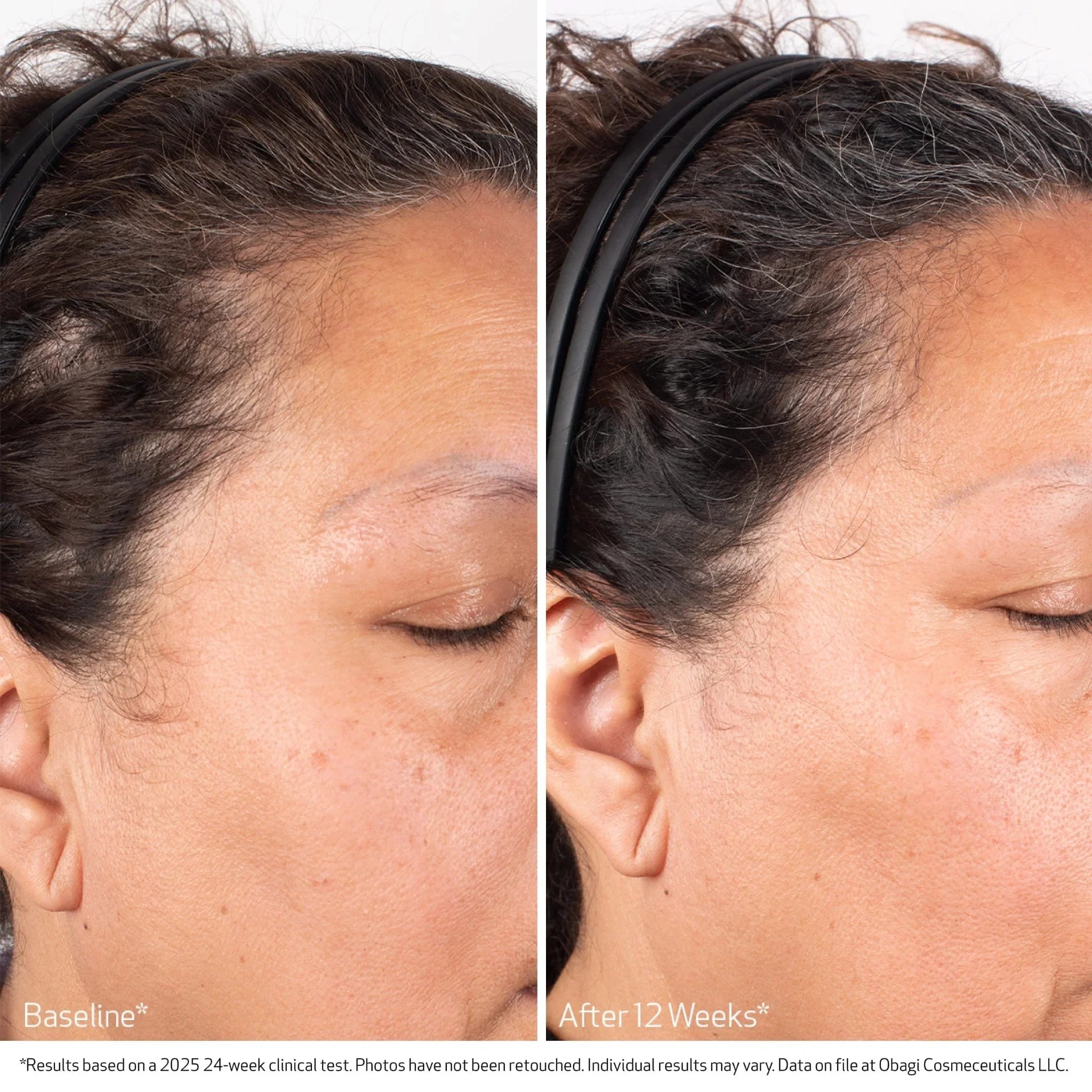 Nu-Cil BioStim™ Scalp Serum