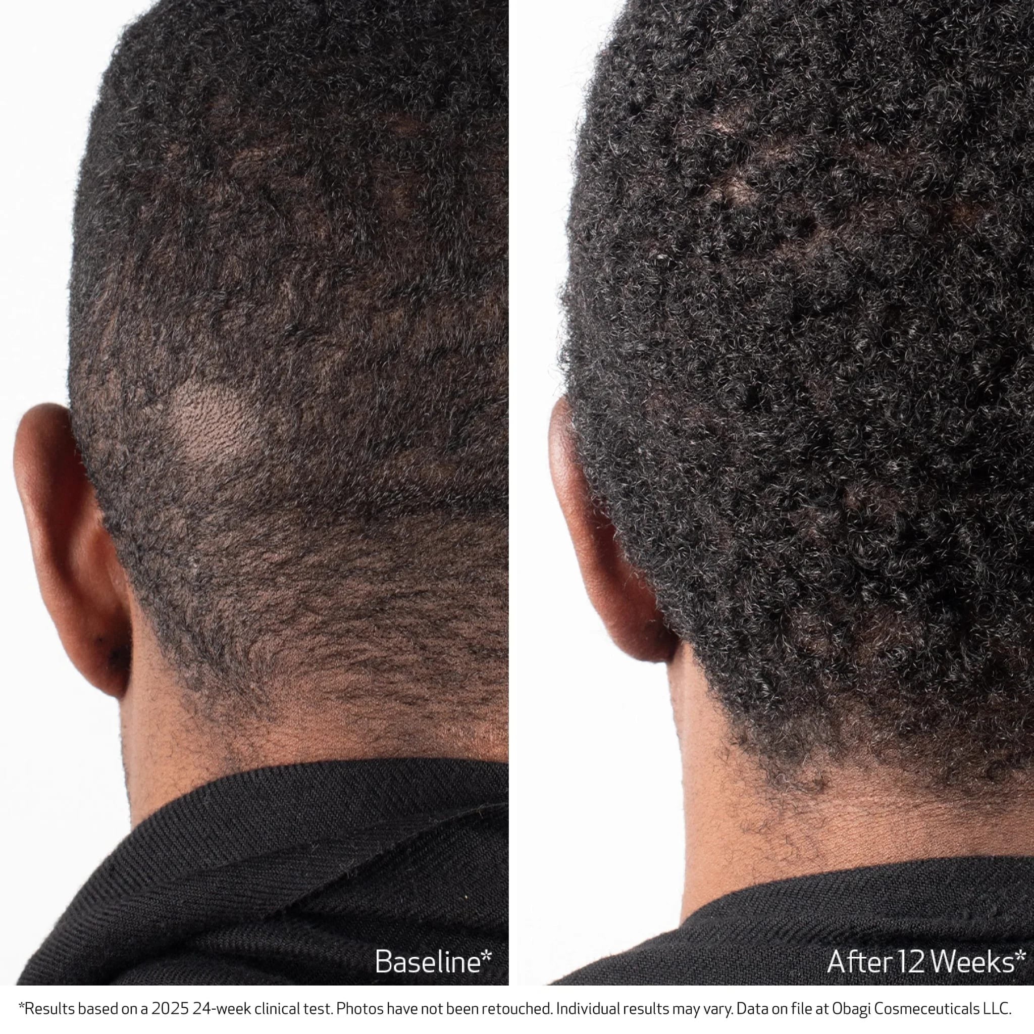 Nu-Cil BioStim™ Scalp Serum