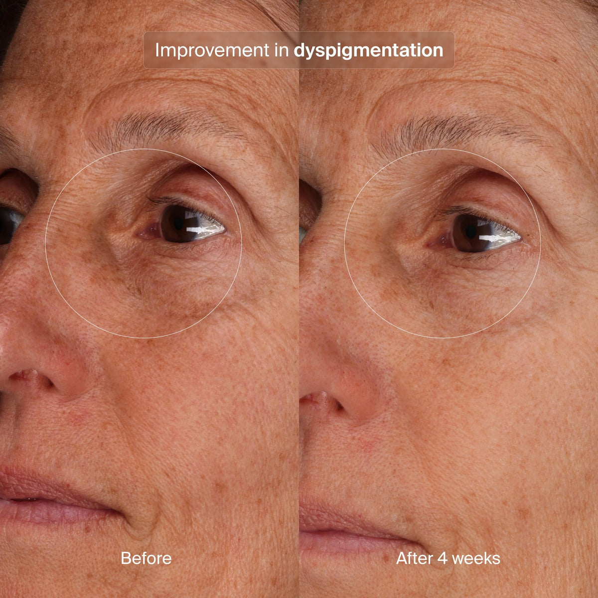 pavise-bioadaptive-stress-repair-1