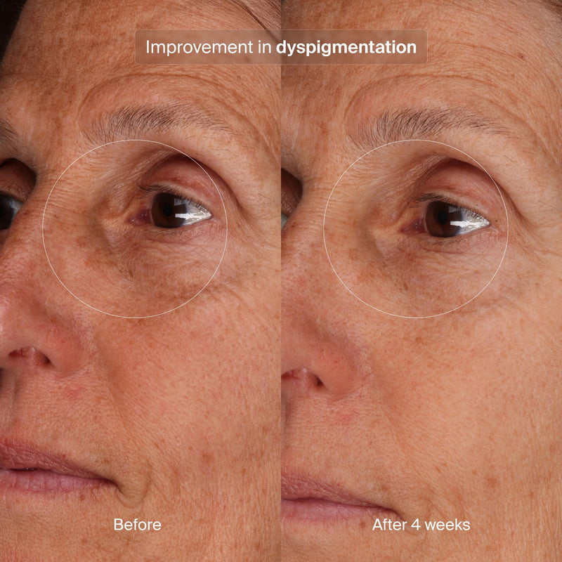 pavise-bioadaptive-stress-repair-1