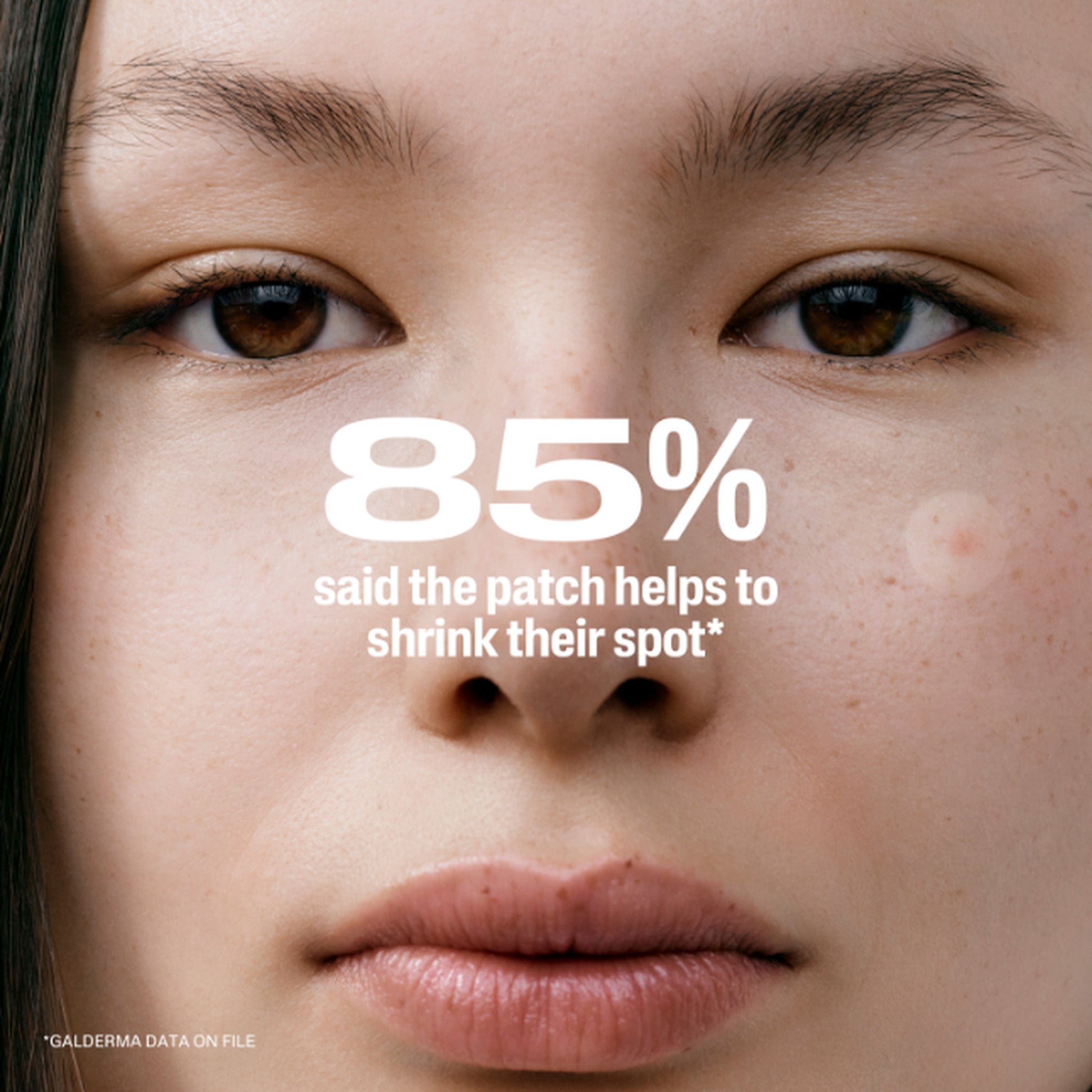 Fast Rescue Pimple Patches