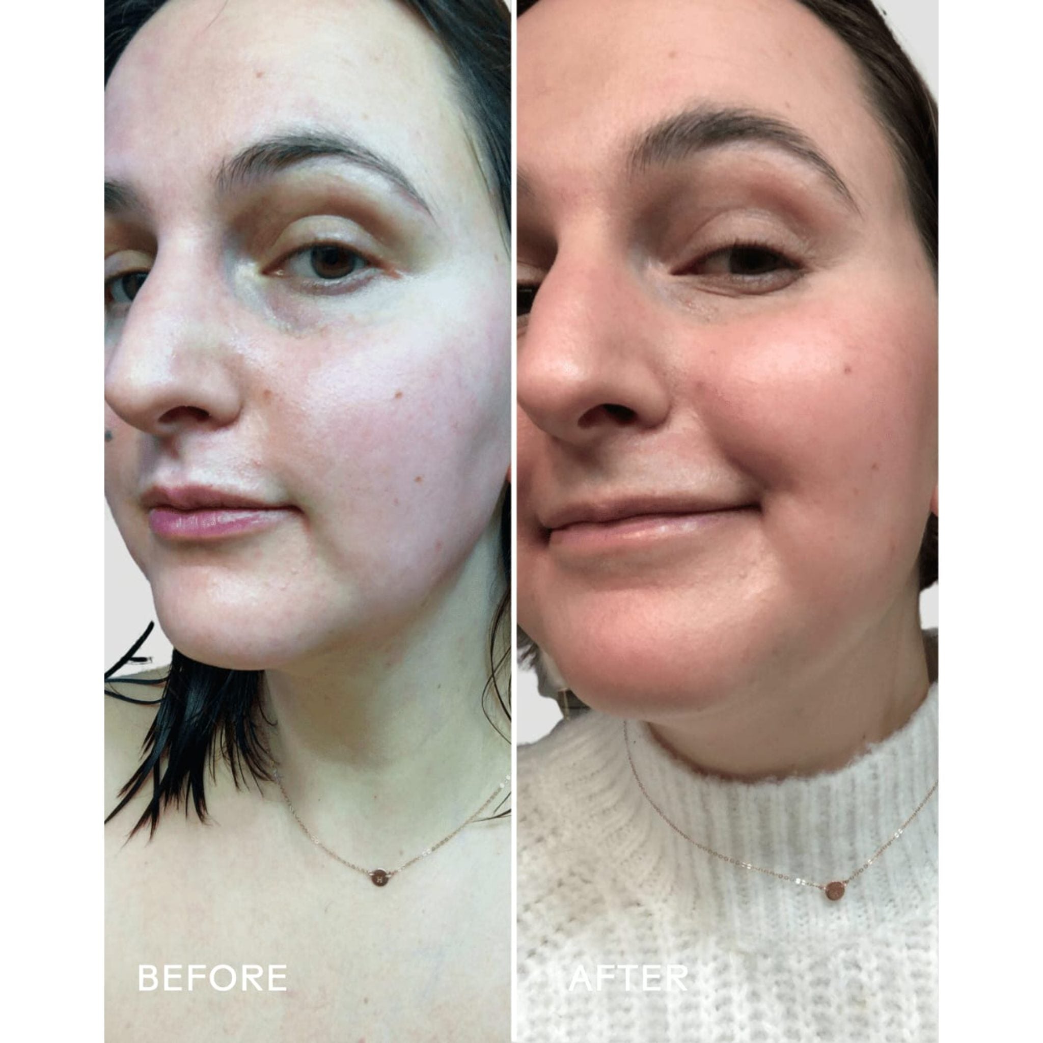 Boost 49% Rosehip Oil Serum