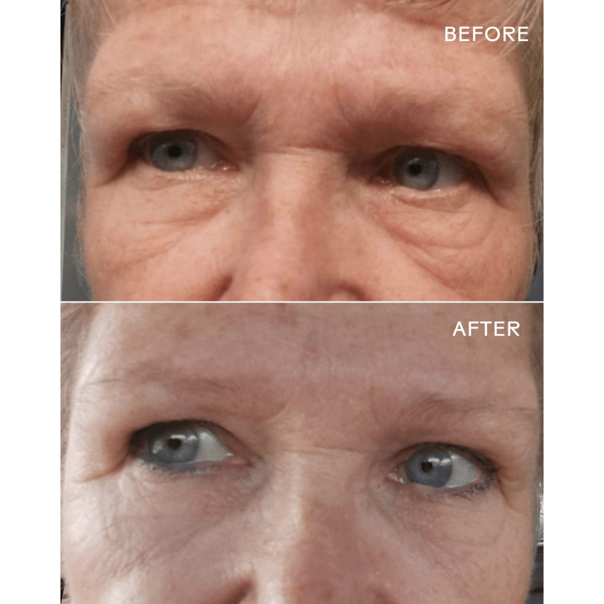 EyeHero ® Bio-Retinol Smoothing Eye Cream