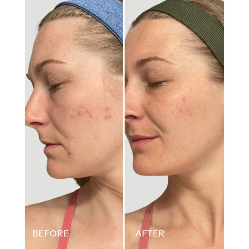 Refresh Papaya + Salicylic Acid Cleanser