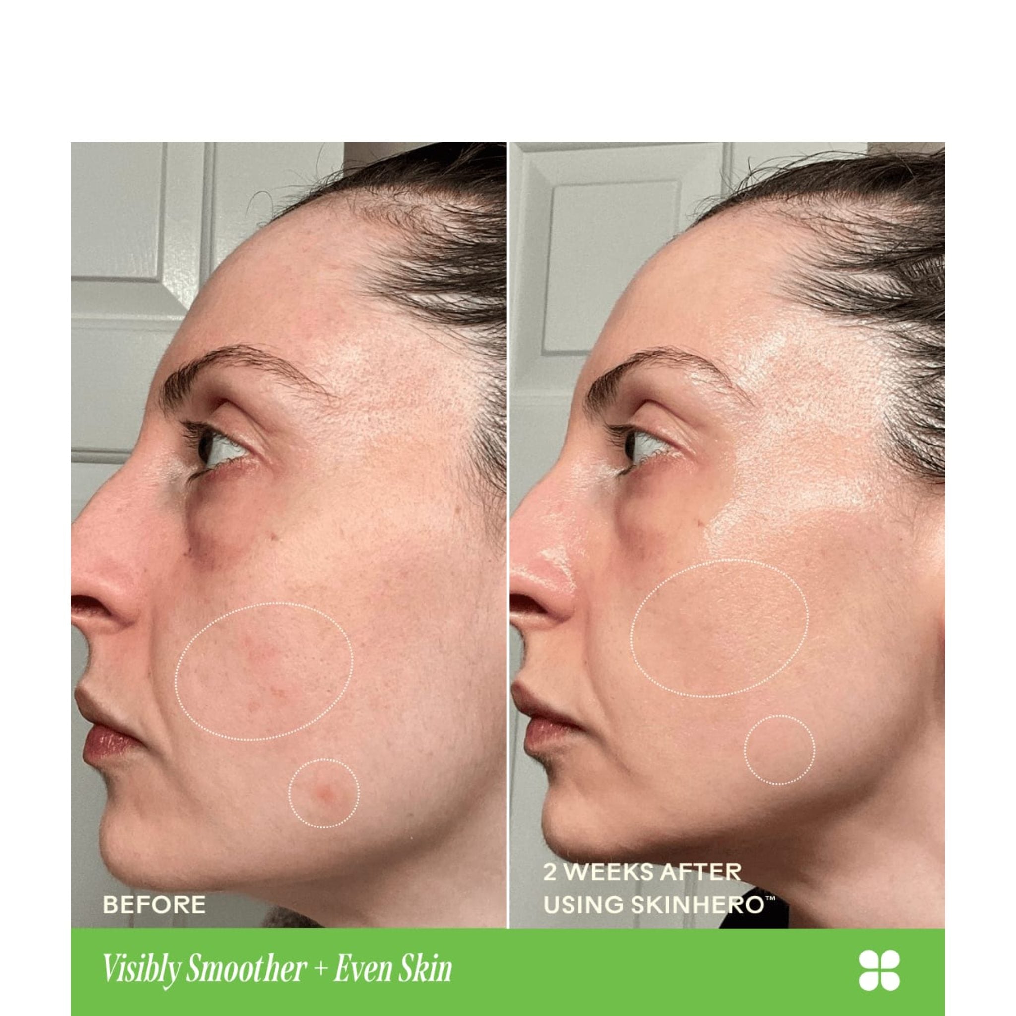 SkinHero™ Bio-Retinol Serum