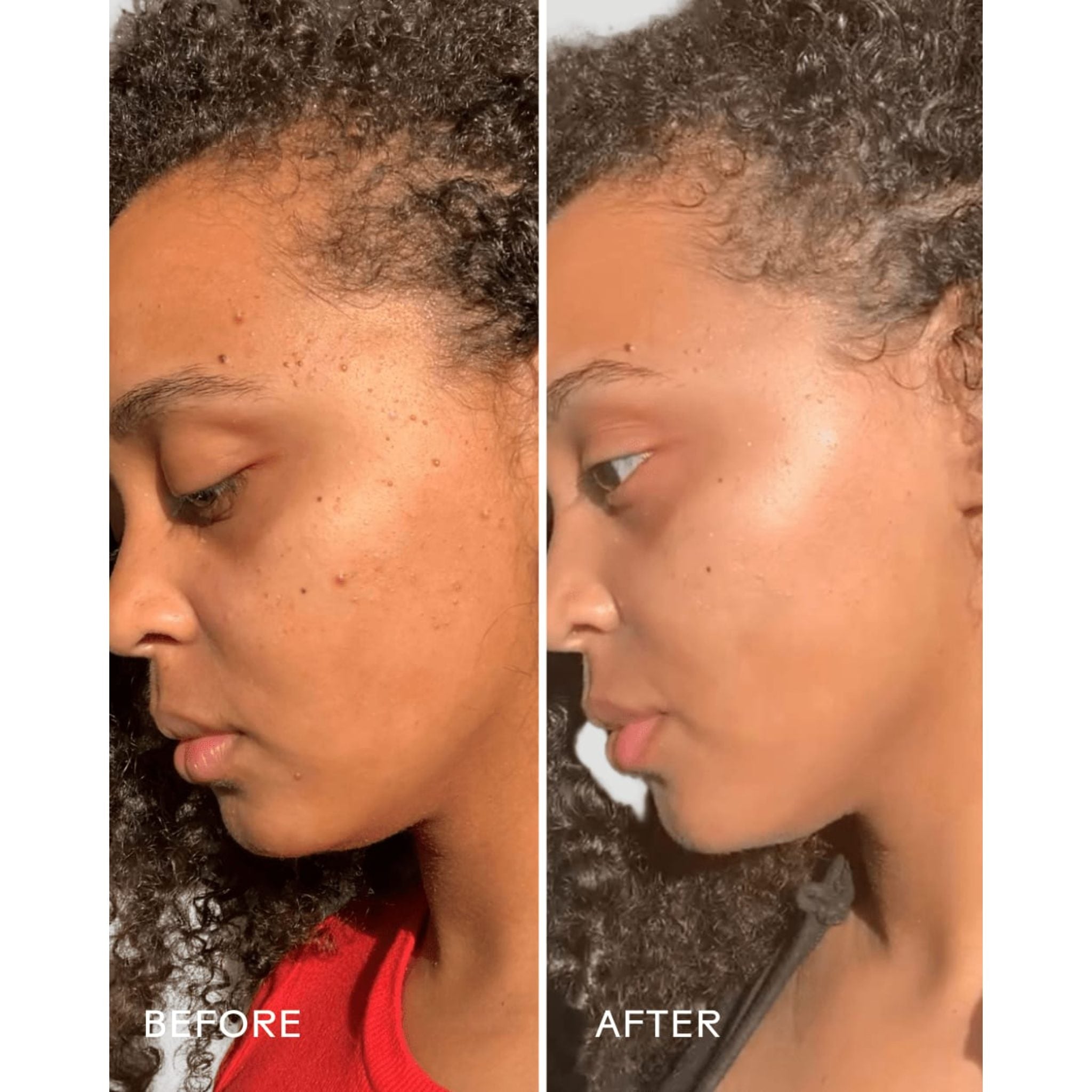 Superfruit AHA Exfoliating Mask ®