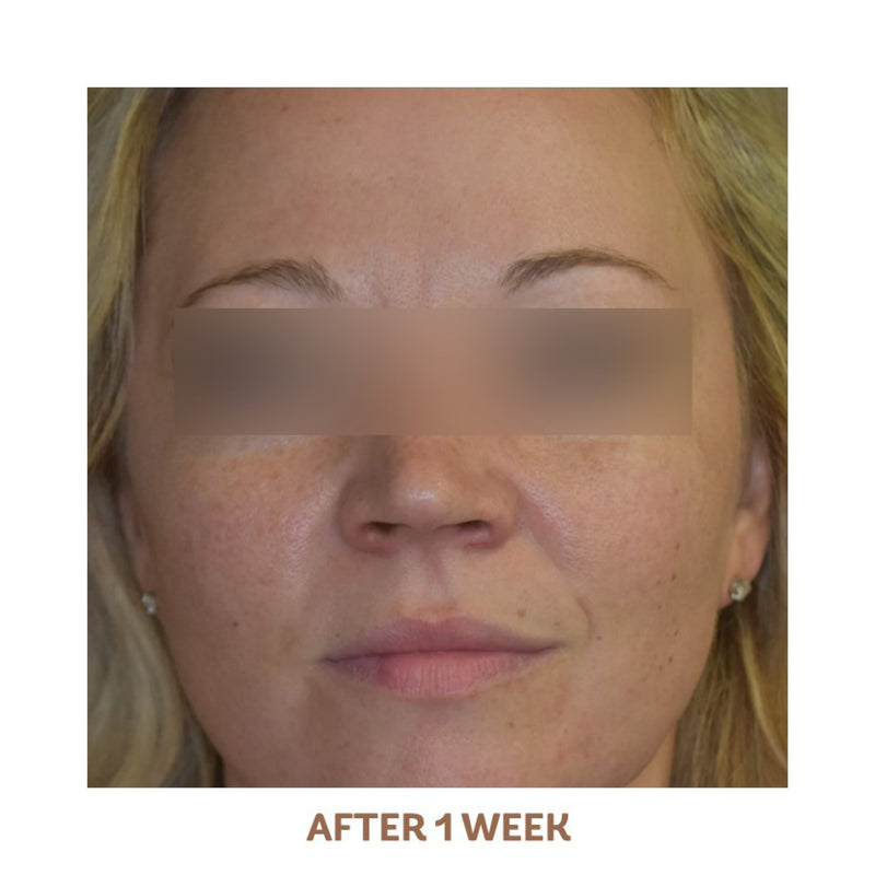 vivier grenzcine serum after