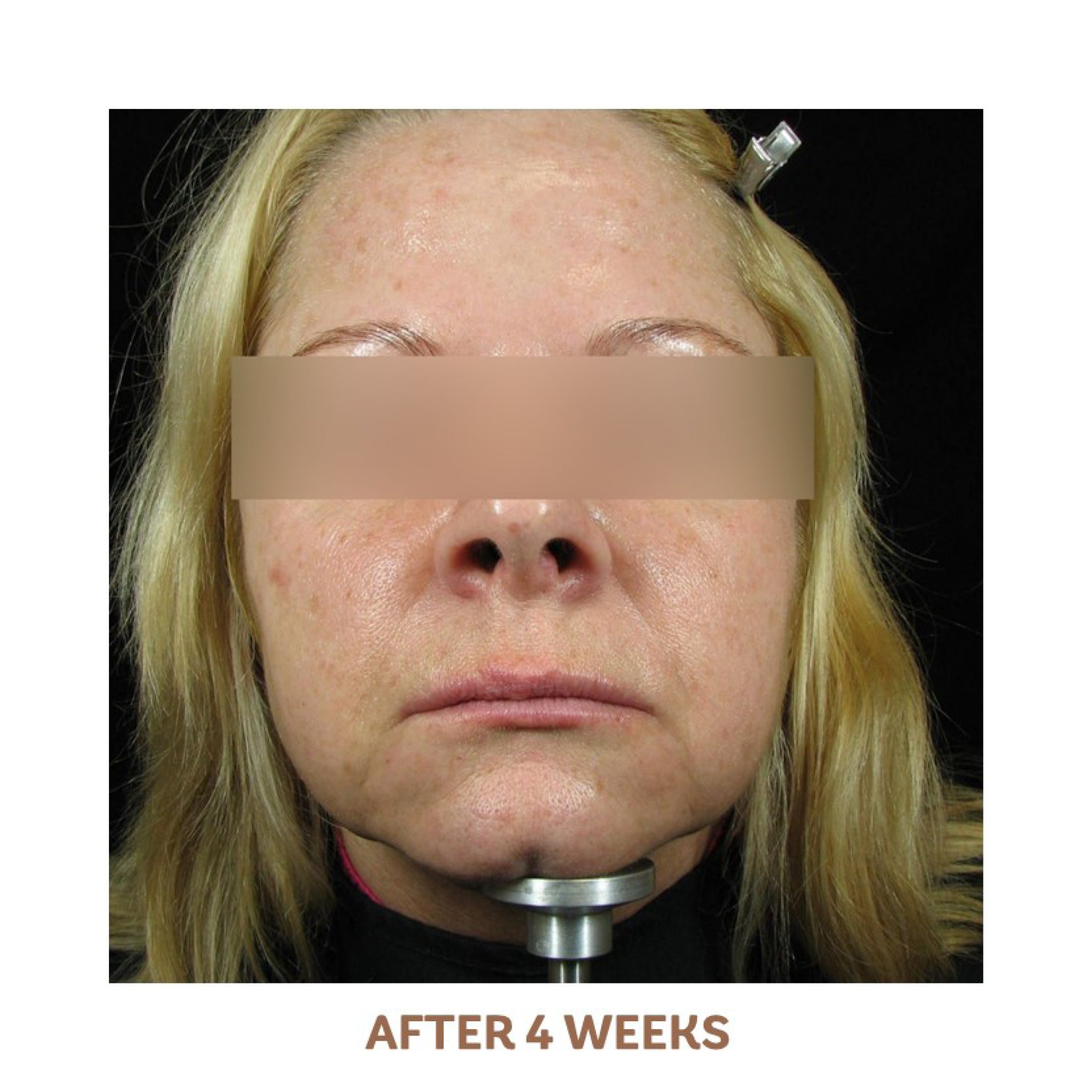 vivier c e peptides after