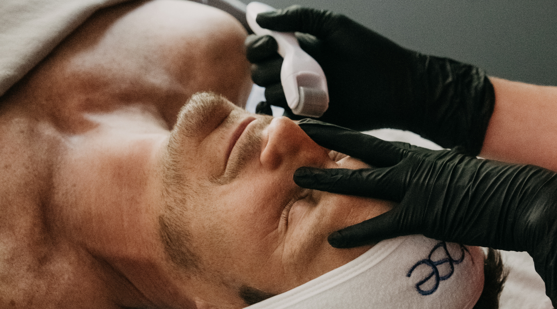 Microdermabrasion VS Microneedling