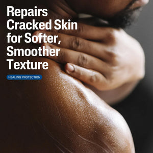 Urea 10 Healing Lotion
