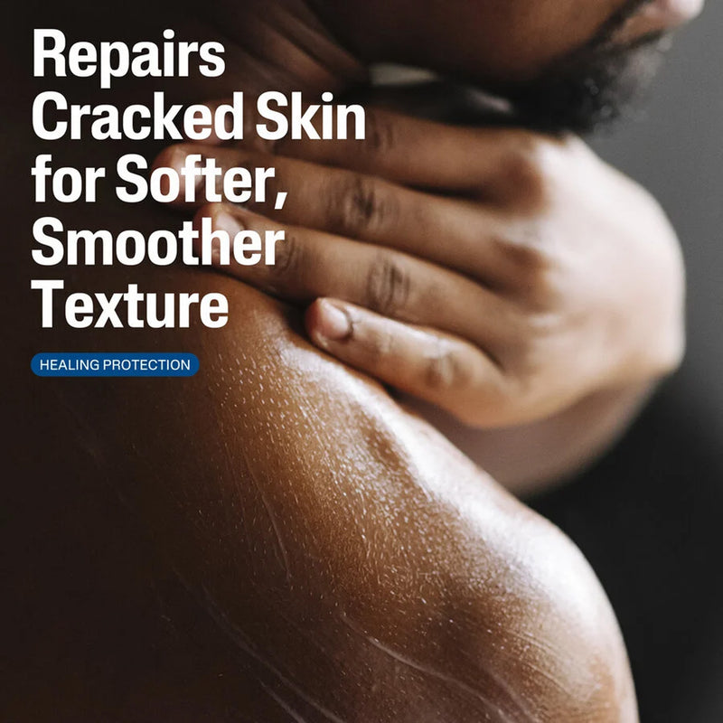 Urea 10 Healing Lotion