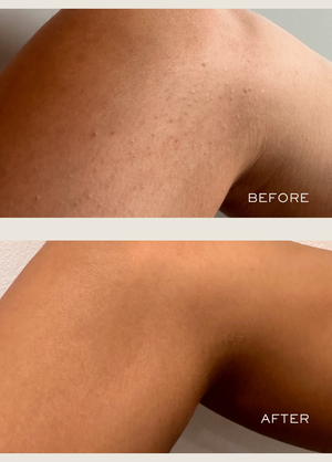 Exfoliating Body Serum