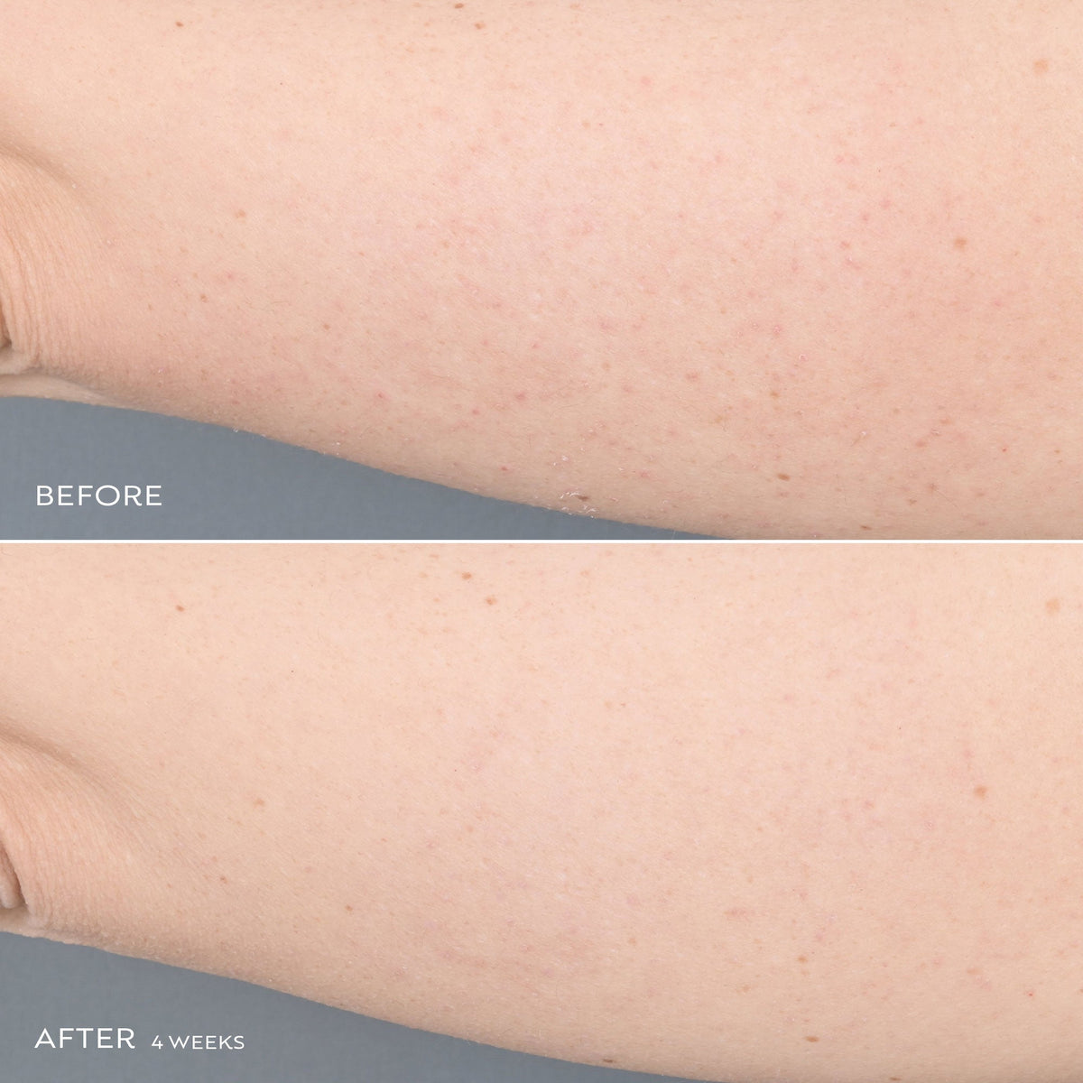 Kaleidoscope Body Serum