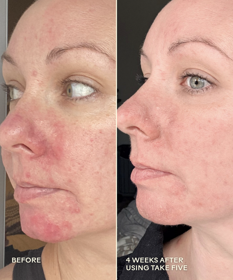 Take Five Hypochlorous Acid Balancing Body + Face Spray