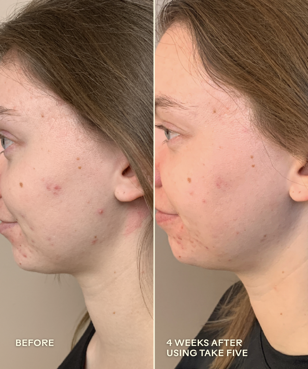 Take Five Hypochlorous Acid Balancing Body + Face Spray