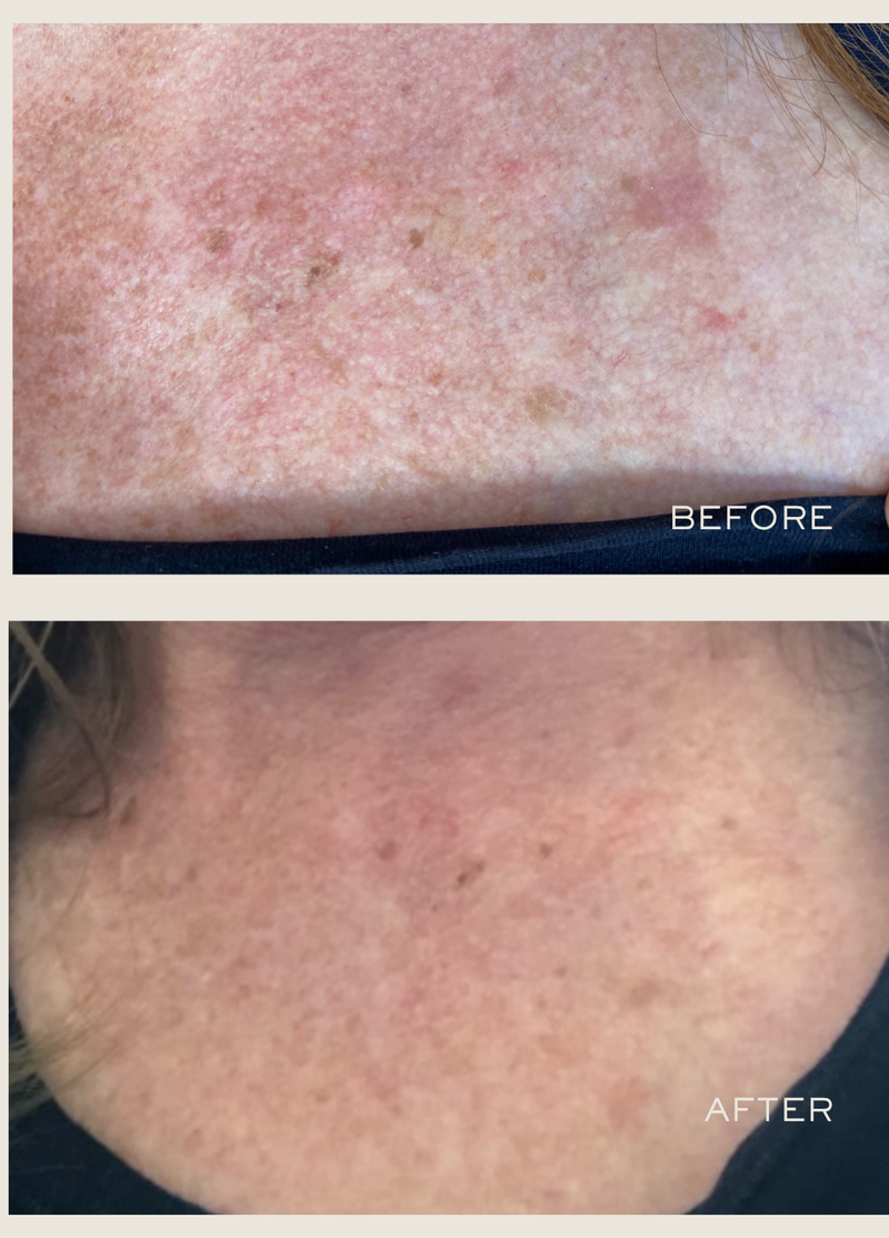 Exfoliating Body Serum