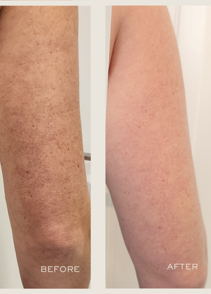 Exfoliating Body Serum