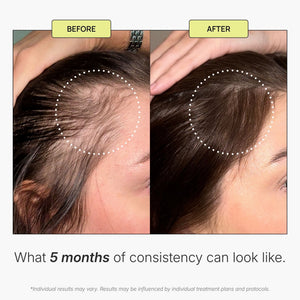 Scalp Stimulating Solution