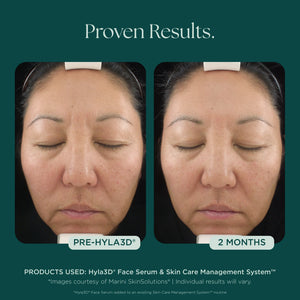 Hyla3D Face Serum