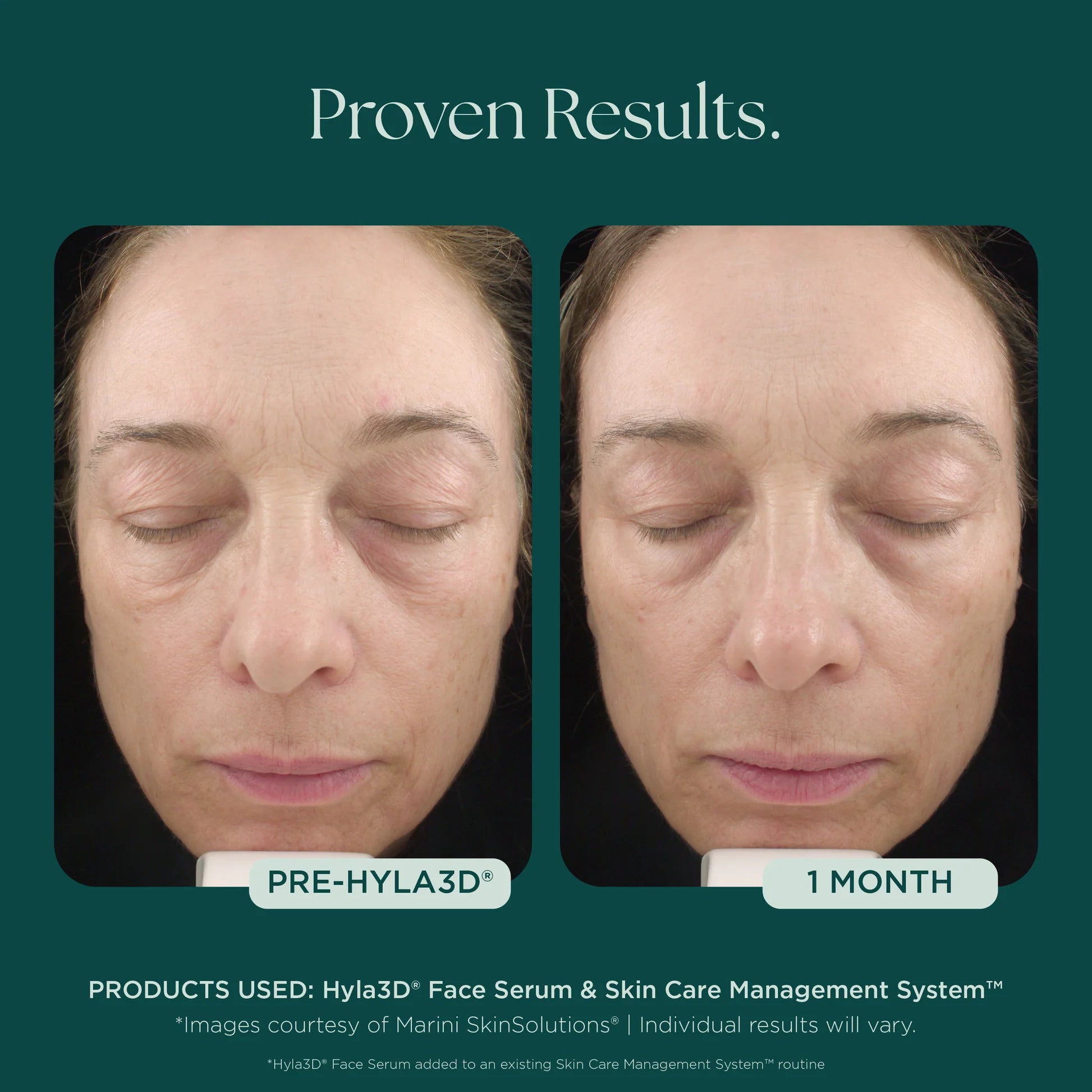 Hyla3D Face Serum